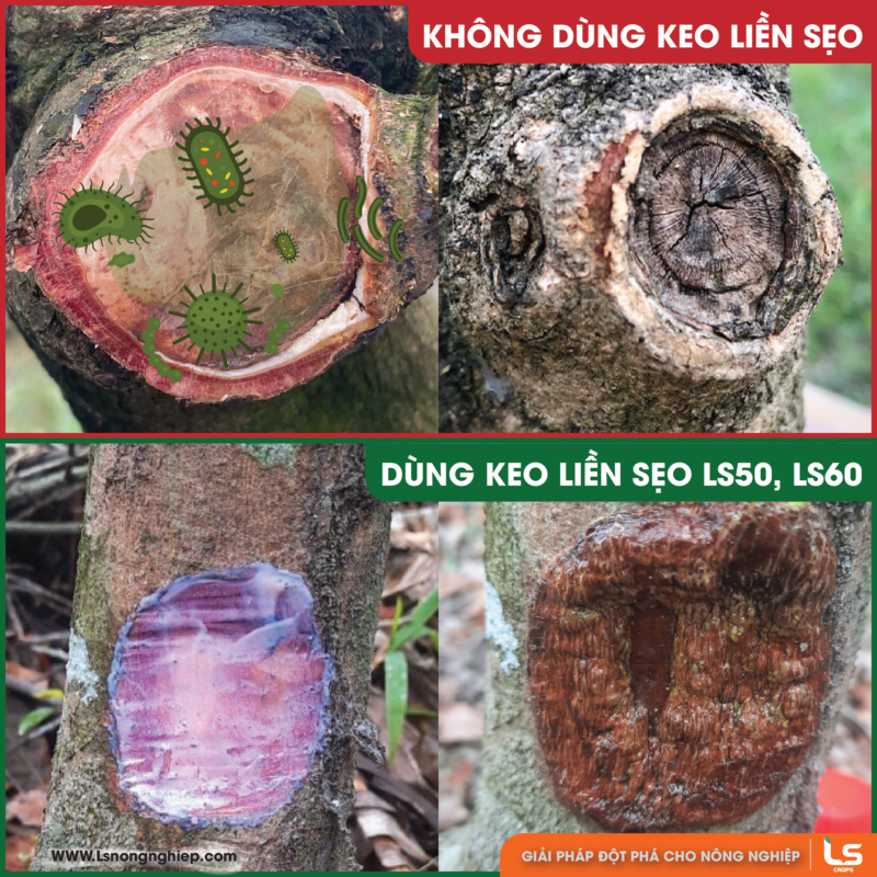 sự khác nhau khi dùng và không dùng keo liền sẹo